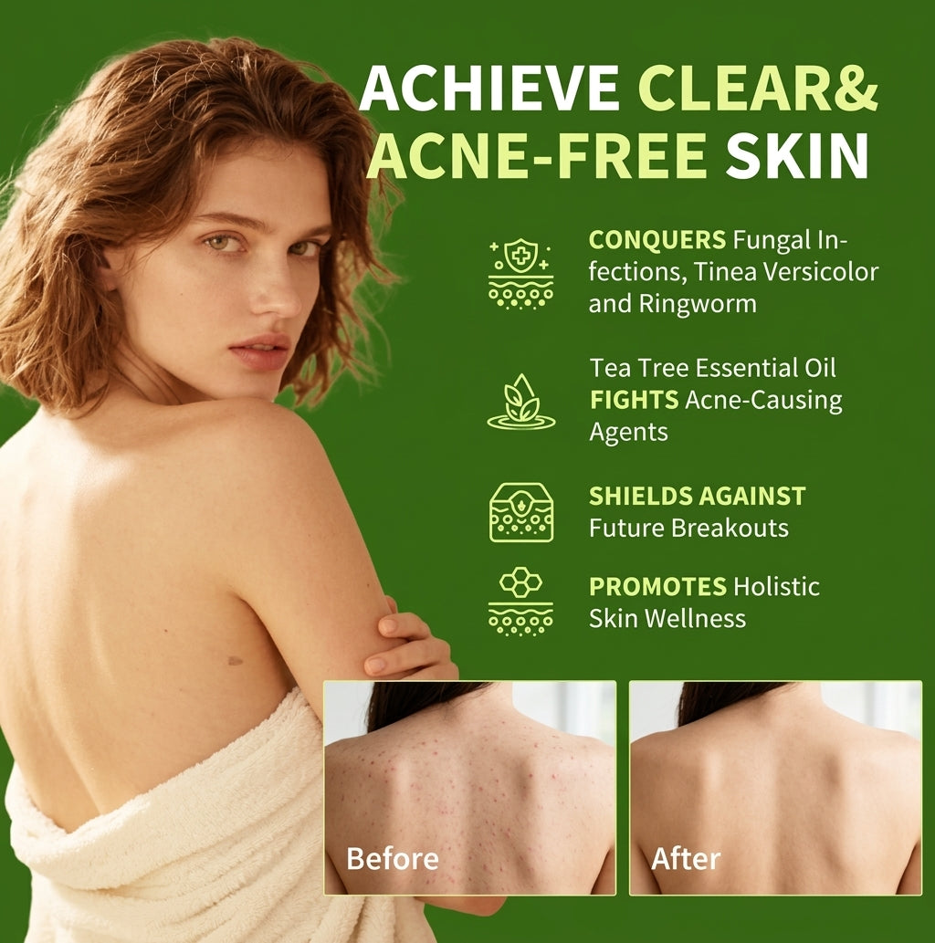 Honety™ Antifungal Soap Bar